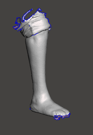 AFOLimbScan