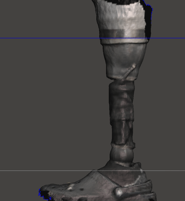 CCProstheticScan