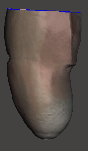 Plaster Positive
