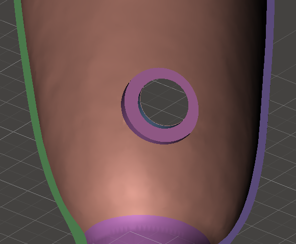 Lyn Valve Back