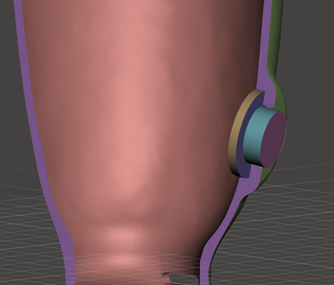 Lyn Valve Cross Section